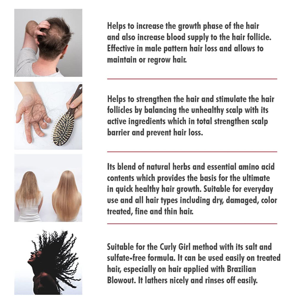 Swissoderm Hair Loss Shampoo - Normal & Dry Hair | 300 ml