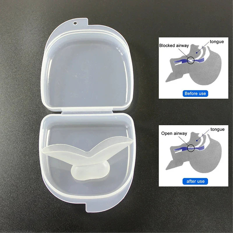 Tongue Retaining Mouthpiece for Snoring Relief | Medical Silicone Sleep Aid